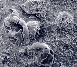 Microbiologically influenced corrosion (MIC) of failed sprinkler pipe