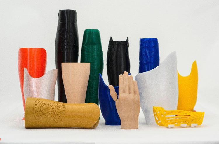 Image 3D printed components prosthetics orthotics