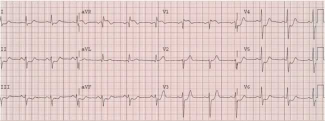 Electrocardiogram image