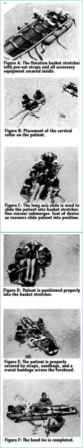 Spinal Immobilization