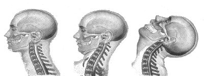 Whiplash Sequence