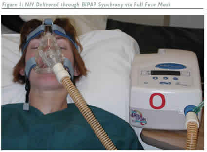 NIV Delivered Through BIPAP...